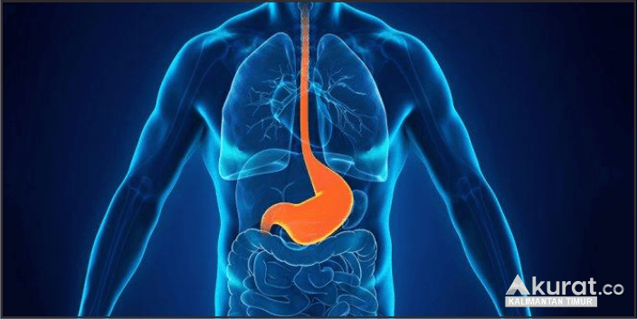 Mengatasi GERD dengan Bijak: Diet Sehat untuk Redakan Gejala Refluks Asam